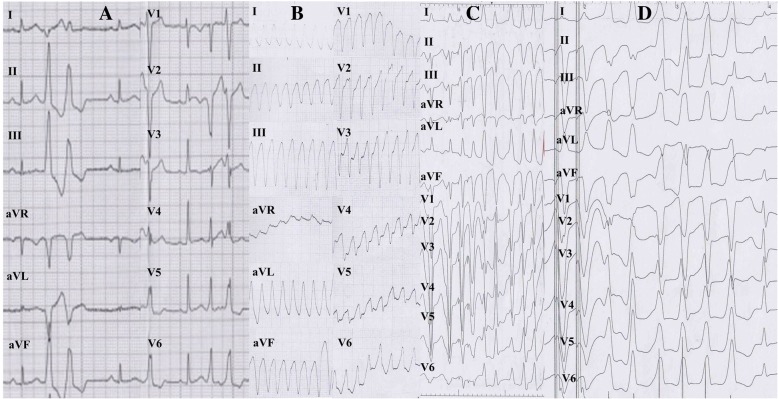 Fig. 2