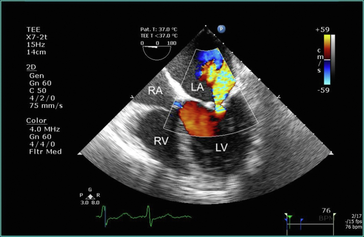 Figure 4