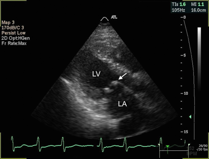 Figure 2