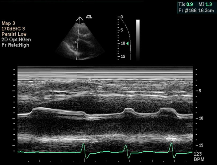 Figure 3