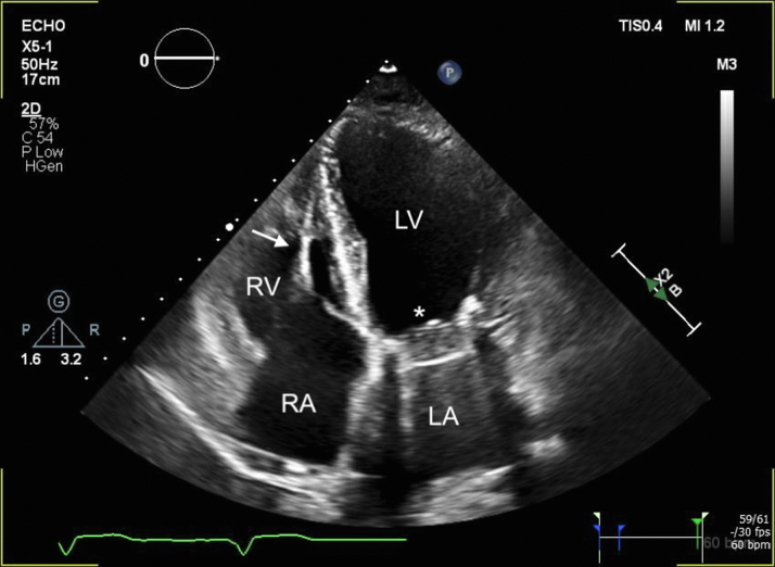 Figure 5