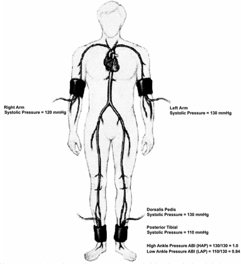 Fig. (1)