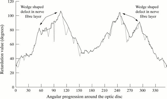 Figure 6  