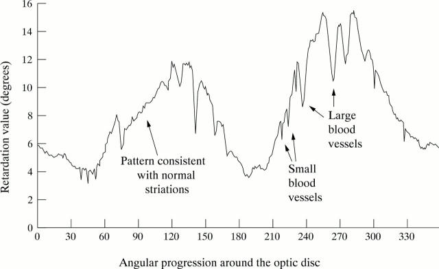 Figure 1  