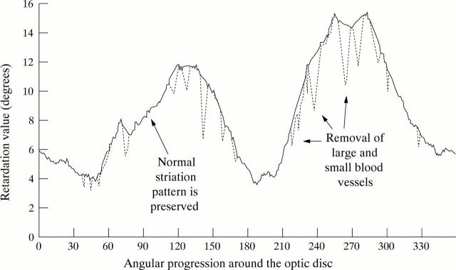 Figure 4  