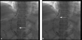 Fig. 11