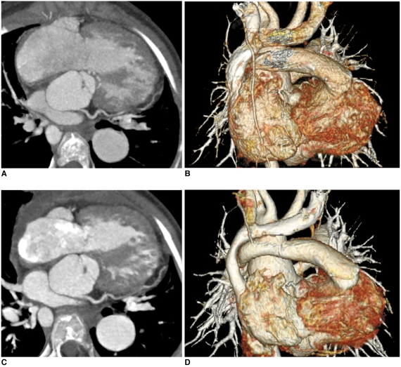 Fig. 11