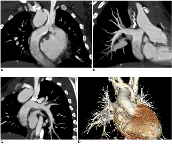 Fig. 12