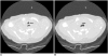 Fig. 10