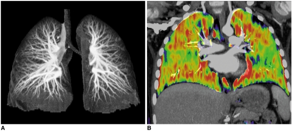 Fig. 14