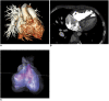 Fig. 13