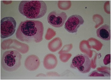 Fig. 1