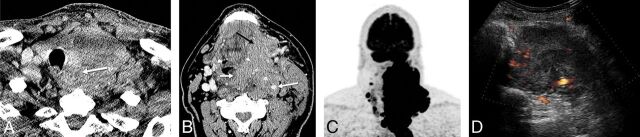 Fig 2.