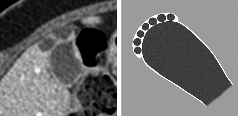 Fig 5.