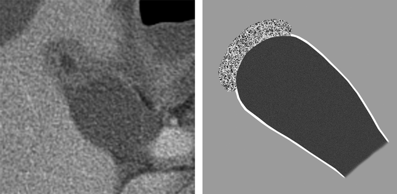 Fig 6.