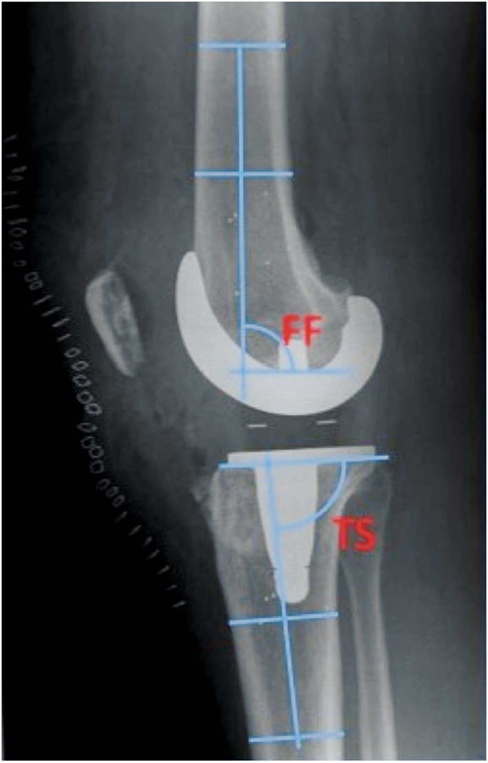 Figure 2.