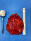 Fig. 2