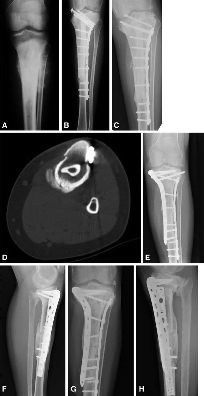 Fig. 3A–H