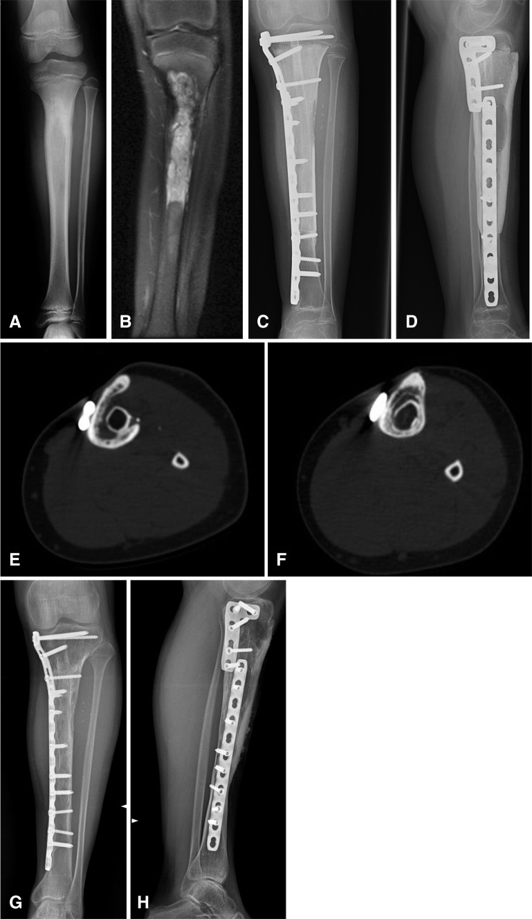 Fig. 1A–H