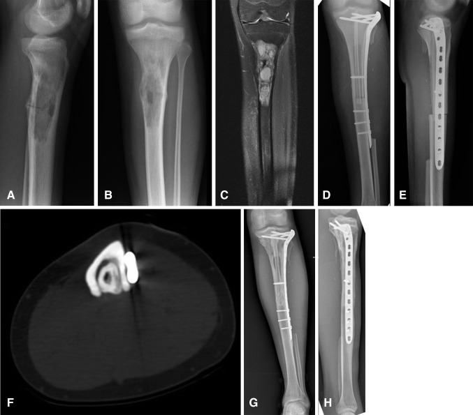 Fig. 2A–H