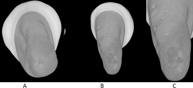 Figure 2. Three-dimensional illustration of the micro-CT image of the mandibular premolar showing root resorption craters (A), LIPUS-treated premolar (B), Control premolar (C), and Root resorption crater in detail. Torque application.