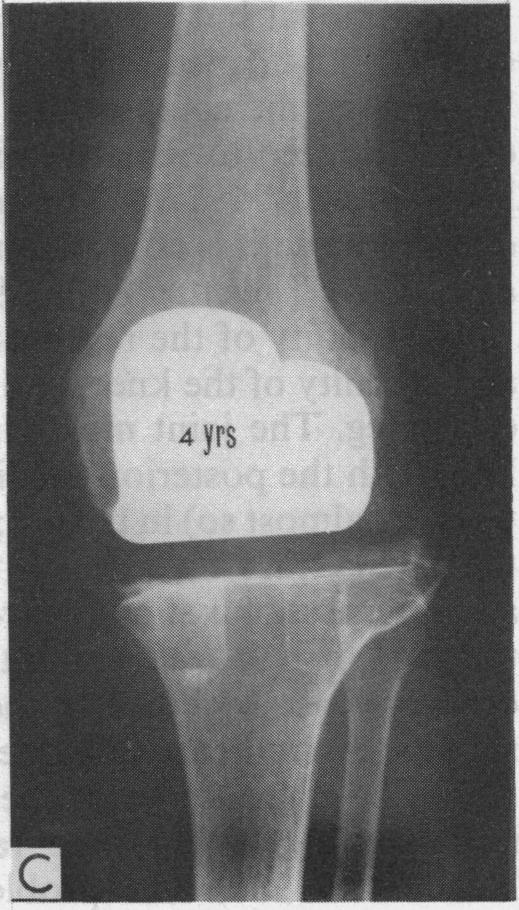 Figure 4. C