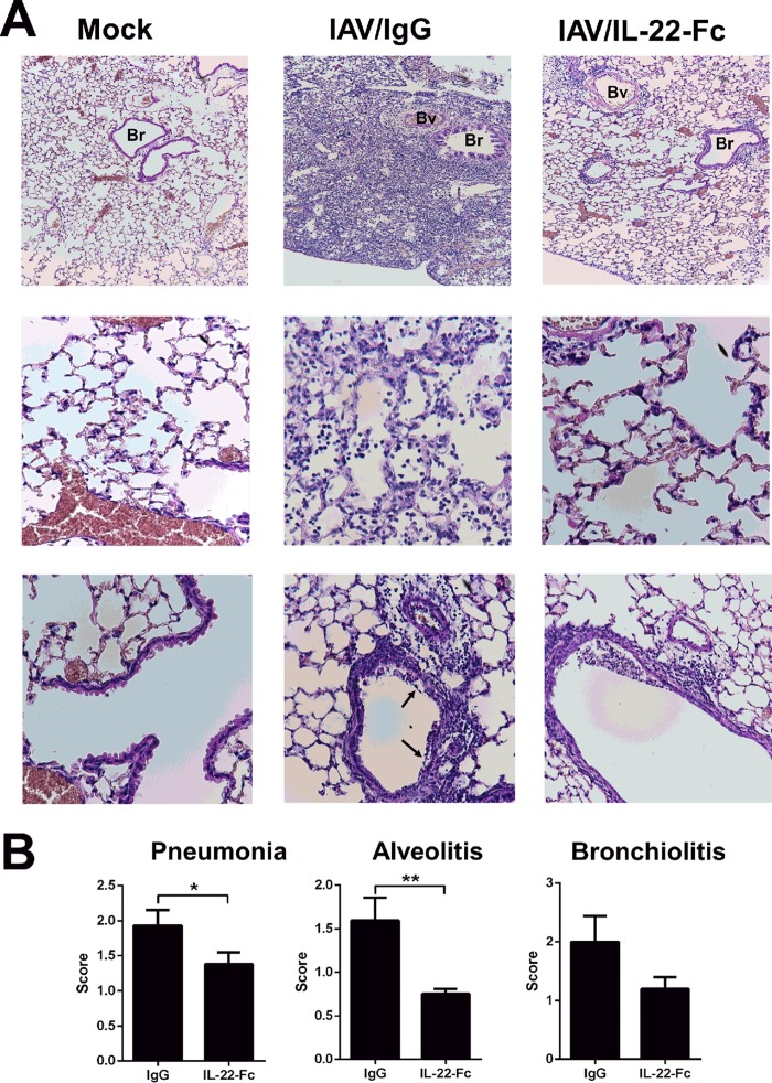 FIG 4