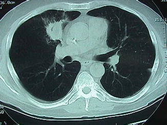 Fig. 10.3