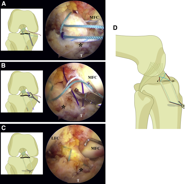 Fig 4