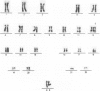 518