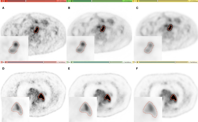 Figure 1