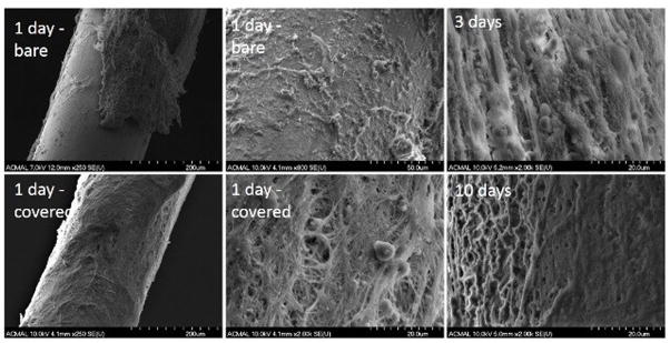 Biodegradable metals for cardiovascular stents: from clinical concerns ...