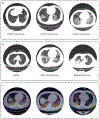 Fig. 3 |