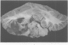 170-1