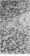 170-5