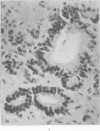 170-3