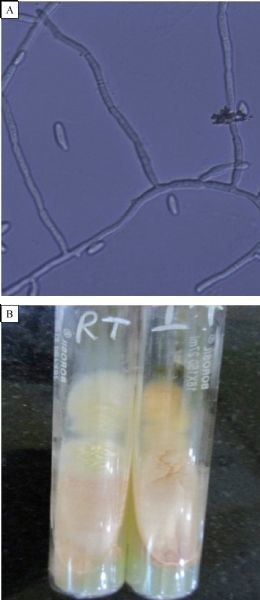 Fig.1