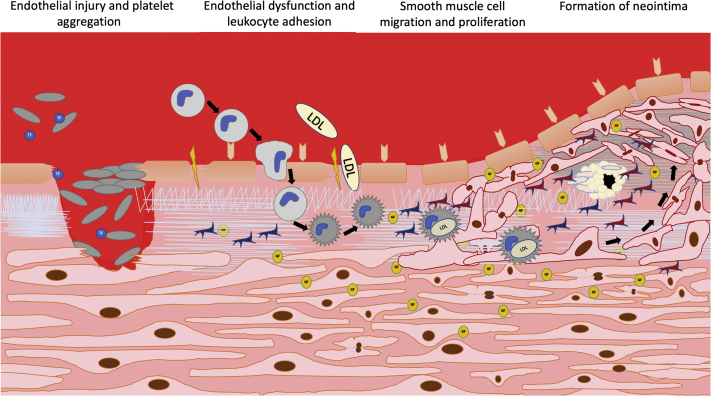 Figure 1