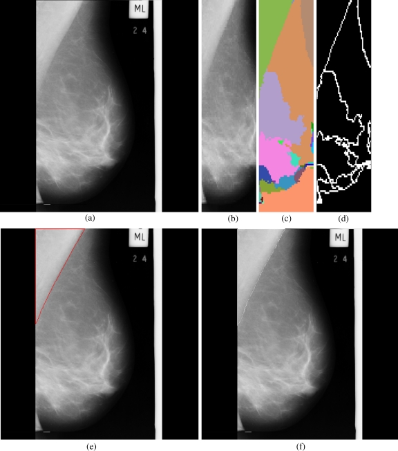 Fig 4