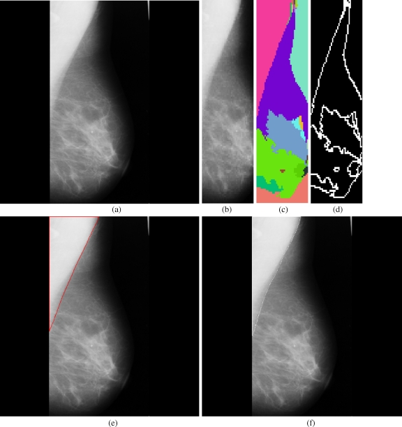 Fig 3