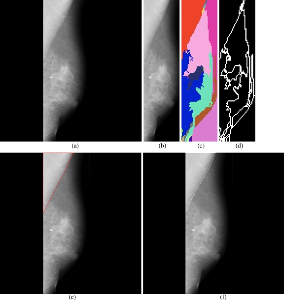 Fig 6