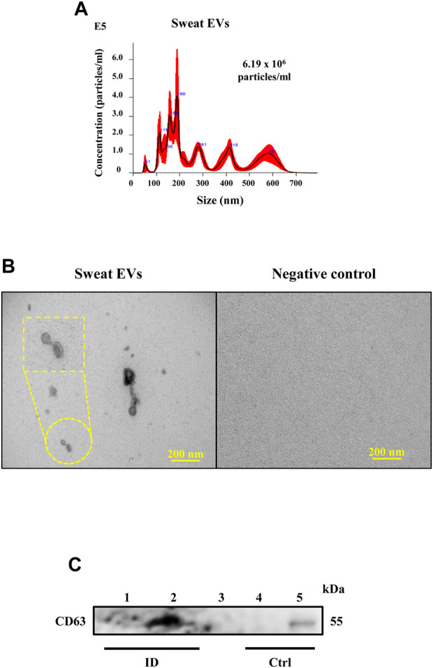 Metabolic patterns of sweat-extracellular vesicles during exercise and ...