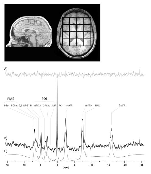 Fig.1