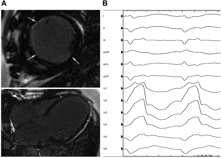 Figure 1