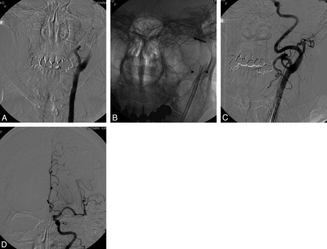 Fig 2.