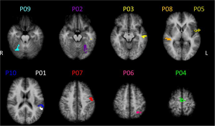 Fig. 3