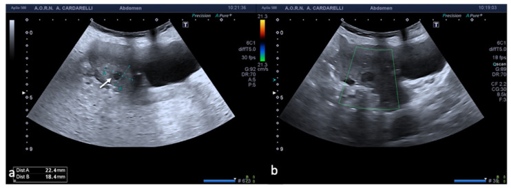 Figure 13