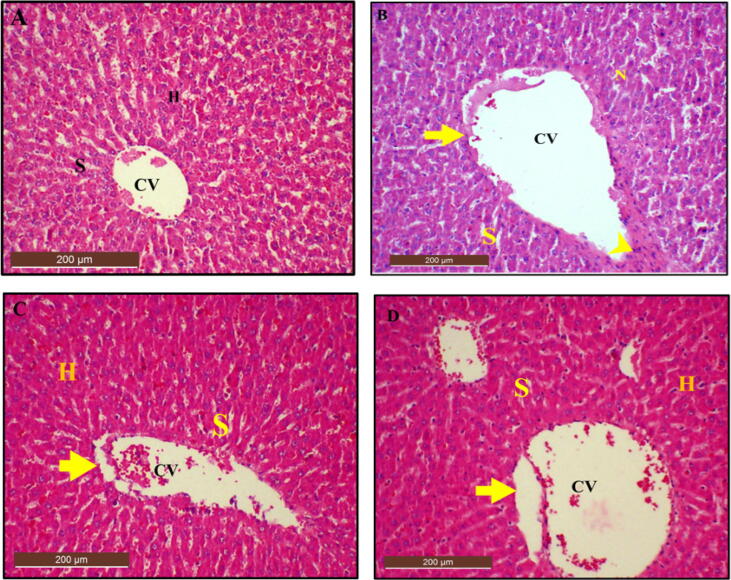 Fig. 14