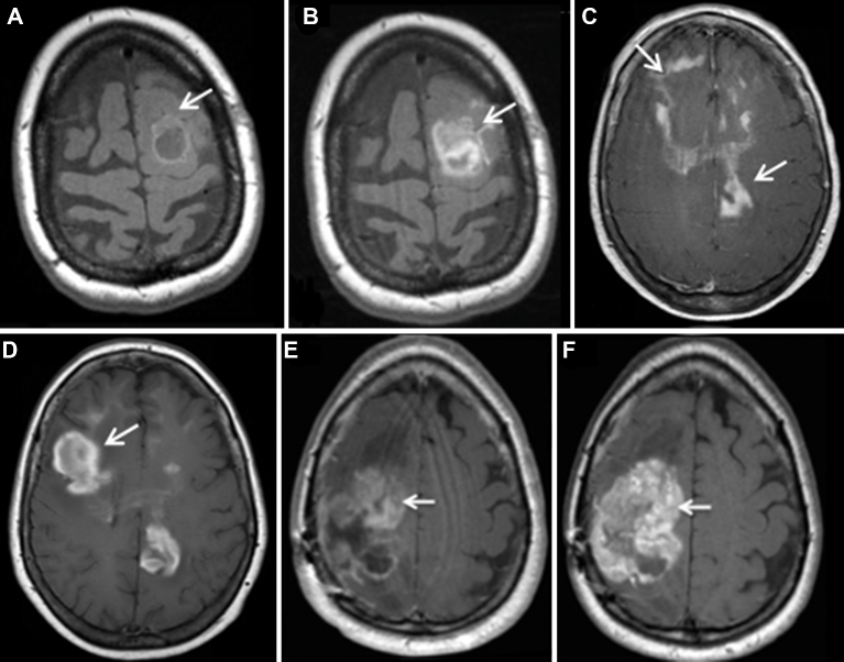 FIGURE 4.