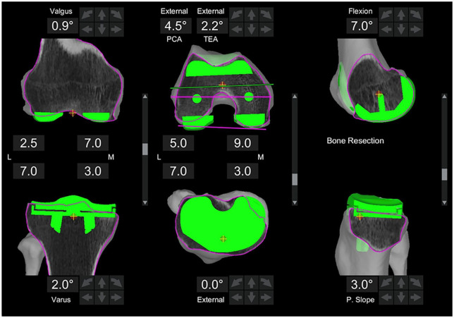 Fig. 2.